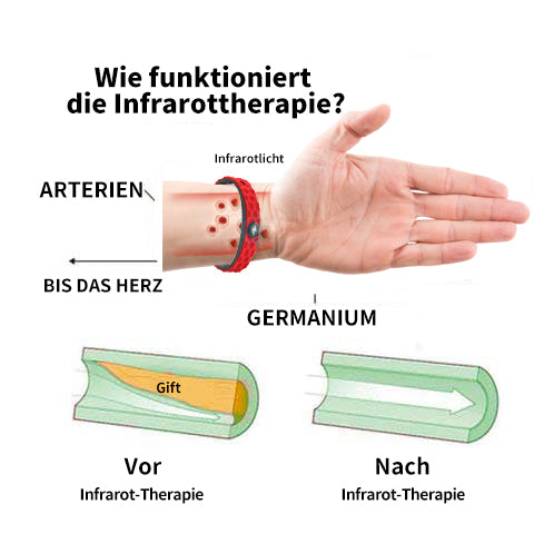 JOFSIT™ Lymphdrainage-Armband aus Titan🎁